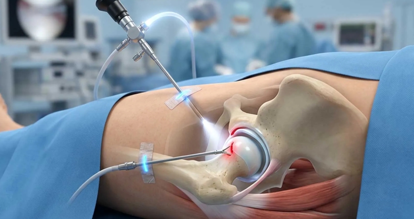 Hip arthroscopy consultation in Faridabad, Delhi NCR