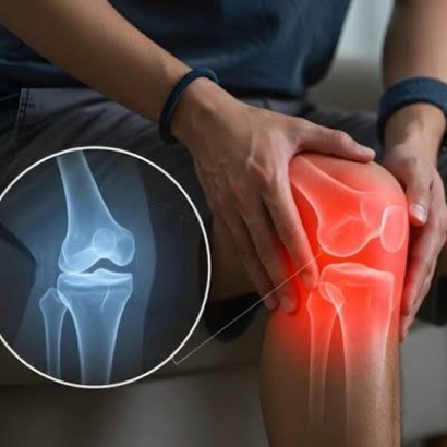 Knee arthritis symptoms and evaluation
