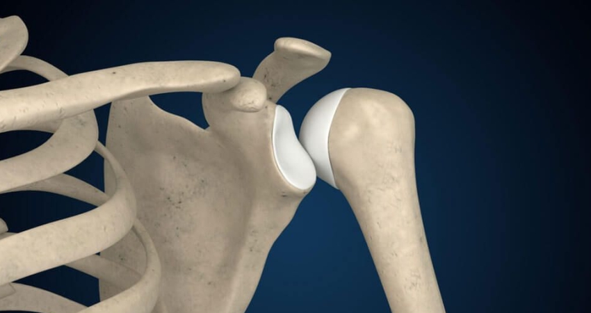 Shoulder Instability / Dislocation in Faridabad