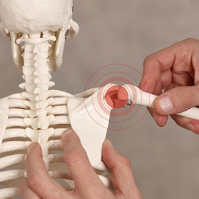 Shoulder replacement surgery and reverse shoulder replacement